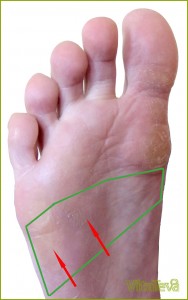 Ожирение печени