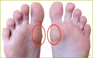 Сердечно- сосудистая система